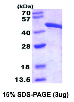 Fumarase human recombinant, expressed in E. coli, &#8805;95% (SDS-PAGE)