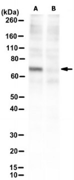 Anti-METTL3 Antibody, clone 29C8