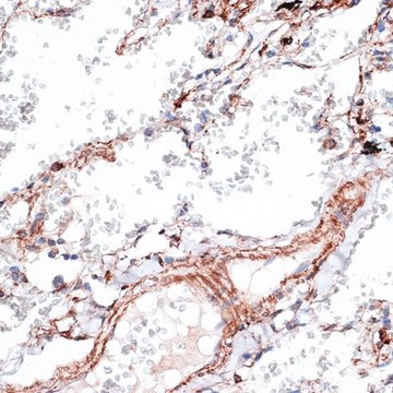 Anti-Vimentin antibody produced in rabbit