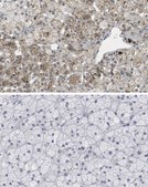 Anti-CCL4/MIP1β Antibody, clone 4G11.10.5