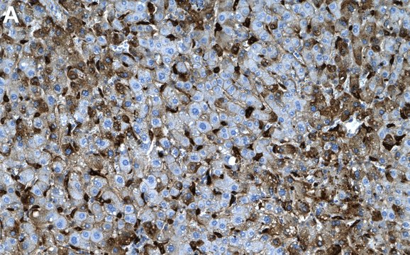 Anti-C1QA Antibody, clone 1M12 ZooMAb&#174; Rabbit Monoclonal recombinant, expressed in HEK 293 cells