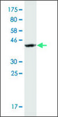 Monoclonal Anti-SSBP2 antibody produced in mouse clone 2E7, purified immunoglobulin, buffered aqueous solution
