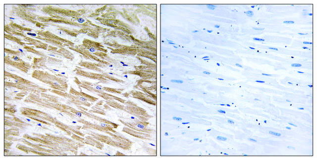 Anti-NEURL2 antibody produced in rabbit affinity isolated antibody