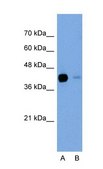 Anti-TGFBI antibody produced in rabbit IgG fraction of antiserum