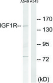 Anti-IGF1R antibody produced in rabbit affinity isolated antibody