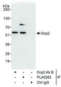 Rabbit anti-Dcp2 Antibody, Affinity Purified Powered by Bethyl Laboratories, Inc.