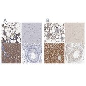 Anti-PYGL antibody produced in rabbit Prestige Antibodies® Powered by Atlas Antibodies, affinity isolated antibody, buffered aqueous glycerol solution