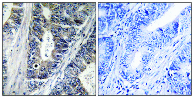 Anti-MAP3K9 antibody produced in rabbit affinity isolated antibody