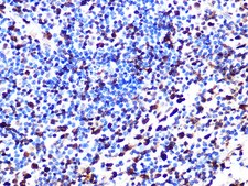 Anti-SAMHD1 Antibody, clone 4C7B3, Rabbit Monoclonal