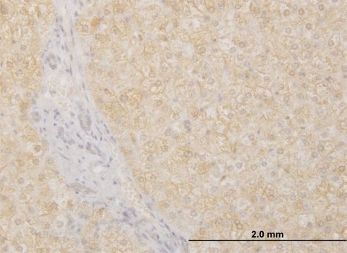 Monoclonal Anti-POMGNT1 antibody produced in mouse clone 6C12, purified immunoglobulin, buffered aqueous solution