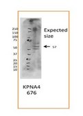 Anti-KPNA4 antibody produced in rabbit affinity isolated antibody