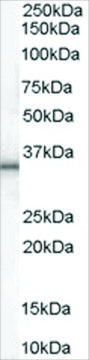 Anti-UCP1 antibody produced in goat affinity isolated antibody, buffered aqueous solution