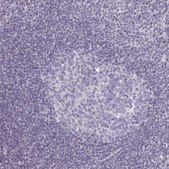 Anti-SEMA6B antibody produced in rabbit Prestige Antibodies® Powered by Atlas Antibodies, affinity isolated antibody, buffered aqueous glycerol solution