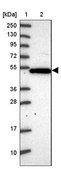 Anti-PSG11 antibody produced in rabbit Prestige Antibodies® Powered by Atlas Antibodies, affinity isolated antibody, buffered aqueous glycerol solution