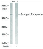 Anti-ESR1 (Ab-118) antibody produced in rabbit affinity isolated antibody