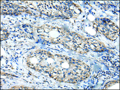 Anti-WDFY2 affinity isolated antibody