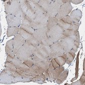 Anti-LSM14B antibody produced in rabbit Prestige Antibodies® Powered by Atlas Antibodies, affinity isolated antibody, buffered aqueous glycerol solution