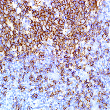 CD20 (SP32) Rabbit Monoclonal Antibody