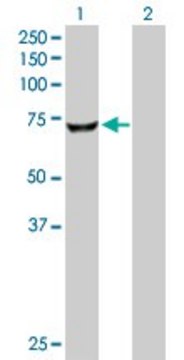 Anti-CROT antibody produced in rabbit purified immunoglobulin, buffered aqueous solution