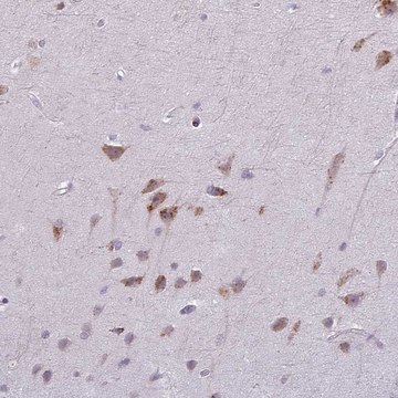 Anti-MAP7D2 antibody produced in rabbit Prestige Antibodies&#174; Powered by Atlas Antibodies, affinity isolated antibody, buffered aqueous glycerol solution