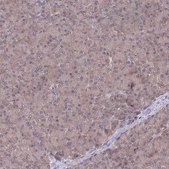 Anti-UBE2N antibody produced in rabbit Prestige Antibodies® Powered by Atlas Antibodies, affinity isolated antibody, buffered aqueous glycerol solution