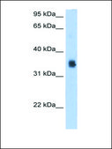 Anti-SLC35F2 antibody produced in rabbit IgG fraction of antiserum