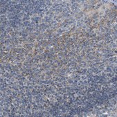 Anti-PDCD1LG2 antibody produced in rabbit Prestige Antibodies® Powered by Atlas Antibodies, affinity isolated antibody, buffered aqueous glycerol solution