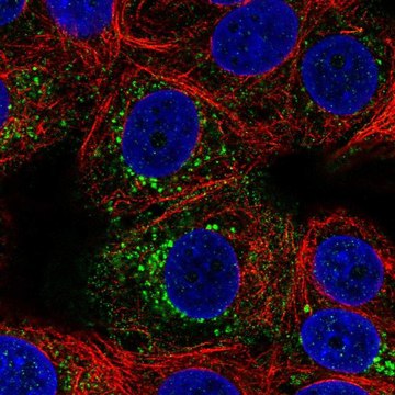 Anti-ACBD7 antibody produced in rabbit Prestige Antibodies&#174; Powered by Atlas Antibodies, affinity isolated antibody