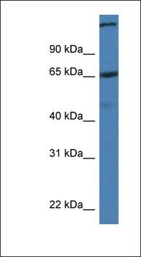 Anti-ST6GALNAC1 antibody produced in rabbit affinity isolated antibody