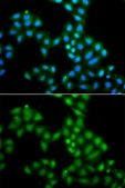 Anti-SAMHD1 antibody produced in rabbit
