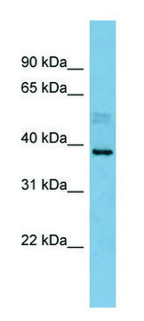 Anti-MARCH8 (N-terminal) antibody produced in rabbit affinity isolated antibody