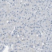 Anti-NUDCD3 antibody produced in rabbit Prestige Antibodies® Powered by Atlas Antibodies, affinity isolated antibody, buffered aqueous glycerol solution, Ab3