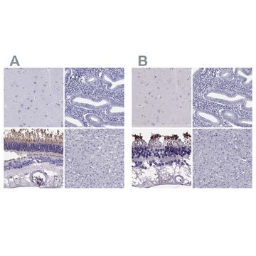 Anti-PDE6A antibody produced in rabbit Prestige Antibodies&#174; Powered by Atlas Antibodies, affinity isolated antibody, buffered aqueous glycerol solution