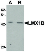 Anti-LMX1B antibody produced in rabbit affinity isolated antibody