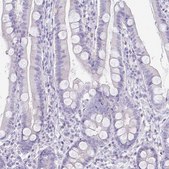 Anti-PAX5 antibody produced in rabbit Prestige Antibodies&#174; Powered by Atlas Antibodies, affinity isolated antibody, buffered aqueous glycerol solution
