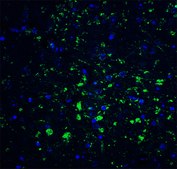 Anti-CDNF (ab1) antibody produced in rabbit affinity isolated antibody, buffered aqueous solution