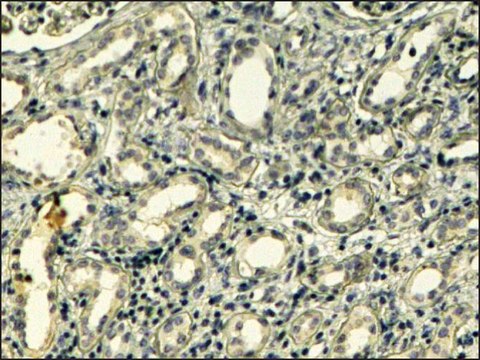 Anti-TNS1 (C-terminal) antibody produced in goat affinity isolated antibody, buffered aqueous solution