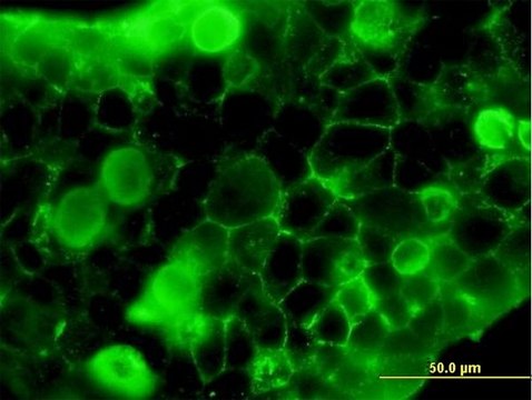 Anti-FLT1 antibody produced in mouse purified immunoglobulin, buffered aqueous solution