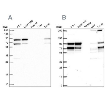 Anti-RANGAP1 antibody produced in rabbit Prestige Antibodies&#174; Powered by Atlas Antibodies, affinity isolated antibody, buffered aqueous glycerol solution