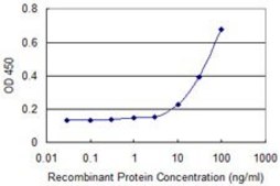Monoclonal Anti-ALOX15B antibody produced in mouse clone 4A7, purified immunoglobulin, buffered aqueous solution