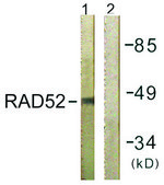 Anti-RAD52 antibody produced in rabbit affinity isolated antibody