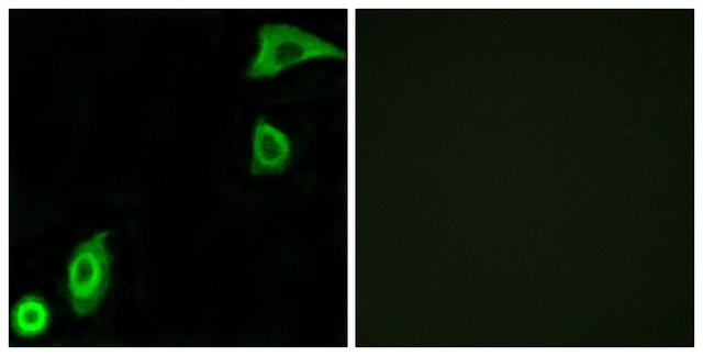 Anti-RPS20 antibody produced in rabbit affinity isolated antibody