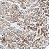 Anti-RHOT2 antibody produced in rabbit Prestige Antibodies® Powered by Atlas Antibodies, affinity isolated antibody, buffered aqueous glycerol solution