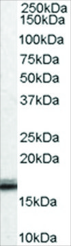 Anti-VHL antibody produced in goat affinity isolated antibody, buffered aqueous solution