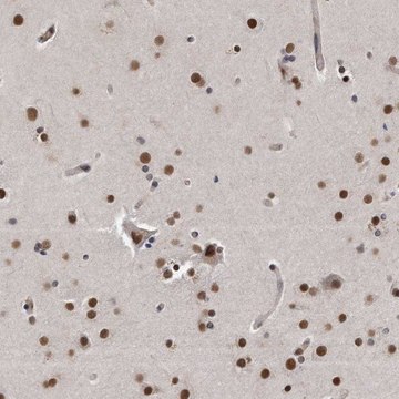 Anti-TP53INP1 antibody produced in rabbit Prestige Antibodies&#174; Powered by Atlas Antibodies, affinity isolated antibody, buffered aqueous glycerol solution