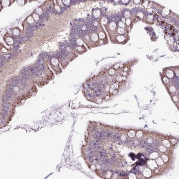 Anti-LZTR1 antibody produced in rabbit Prestige Antibodies&#174; Powered by Atlas Antibodies, affinity isolated antibody, buffered aqueous glycerol solution