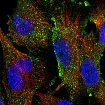 Anti-TAMM41 antibody produced in rabbit Prestige Antibodies&#174; Powered by Atlas Antibodies, affinity isolated antibody