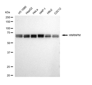 KD-Validated Anti HNRNPM Antibody, clone 23GB4895, Rabbit Monoclonal clone 23GB4895, recombinant rabbit monoclonal, expressed in HEK293 cells