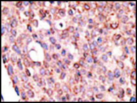 Anti-Cry2 (C-term) antibody produced in rabbit IgG fraction of antiserum, buffered aqueous solution