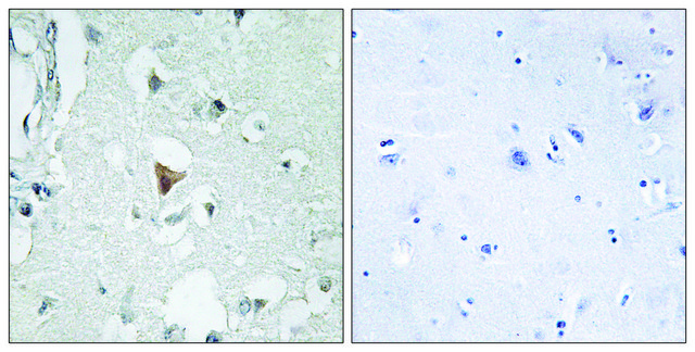 Anti-SAPK antibody produced in rabbit affinity isolated antibody